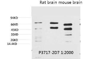 Western blot analysis of 1) Hela, 2) Rat Brain Tissue, 3) Mouse Brain Tissue with Phosphoserine Mouse mAb diluted at 1:2000. (Phosphoserine Antikörper)