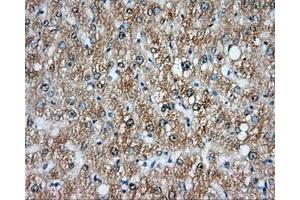 Immunohistochemical staining of paraffin-embedded liver tissue using anti-NIT2 mouse monoclonal antibody. (NIT2 Antikörper)
