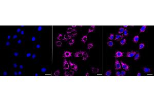 Immunocytochemical staining of HeLa cells with Acyl-CoA dehydrogenase short chain antibody (ABIN7797493), 1:1,000). (Rekombinanter Acyl Co-A Dehydrogenase (AIDB) (chain short) Antikörper)