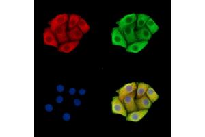 ABIN7095879 and ABIN7099941 staining Hela cells by IF/ICC. (DHX30 Antikörper)