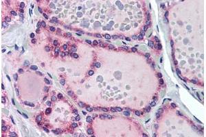 Human Thyroid (formalin-fixed, paraffin-embedded) stained with TRHR antibody ABIN290227 at 10 ug/ml followed by biotinylated goat anti-rabbit IgG secondary antibody ABIN481713, alkaline phosphatase-streptavidin and chromogen. (TRHR Antikörper  (AA 350-400))