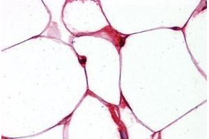 Adipocytes, Human: Formalin-Fixed, Paraffin-Embedded (FFPE) (FABP4 Antikörper  (Tyr20))