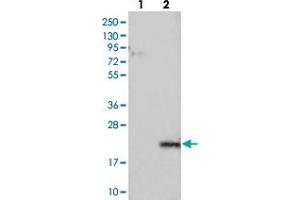 Western blot analysis of Lane 1: Negative control (vector only transfected HEK293T lysate), Lane 2: Over-expression Lysate (Co-expressed with a C-terminal myc-DDK tag (~3. (LYZL6 Antikörper)