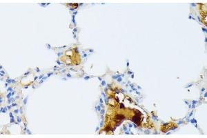 Immunohistochemistry of paraffin-embedded Mouse lung using CTRB1 Polyclonal Antibody at dilution of 1:100 (40x lens). (CTRB1 Antikörper)