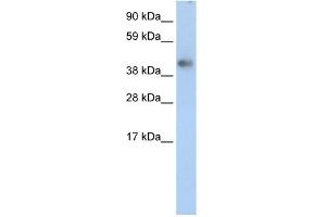WB Suggested Anti-ZNF620 Antibody Titration: 2.