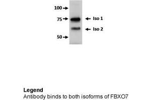 Western Blotting (WB) image for anti-F-Box Protein 7 (FBXO7) (Middle Region) antibody (ABIN2774701)
