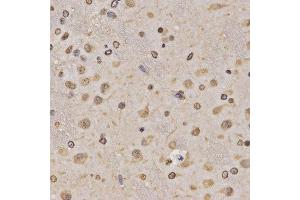 Immunohistochemistry of paraffin-embedded rat brain tissue using H3K36me1 antibody at dilution of 1:200 (x400 lens).