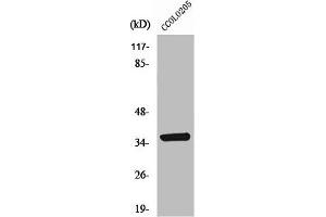 Western Blot analysis of COLO205 cells using AASD-PPT Polyclonal Antibody (AASDHPPT Antikörper  (N-Term))