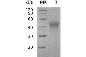 Western Blotting (WB) image for Hepatitis A Virus Cellular Receptor 2 (TIM 3) (AA 20-193) protein (His tag) (ABIN7320694)