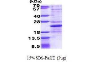 SDS-PAGE (SDS) image for Nescient Helix Loop Helix 1 (NHLH1) (AA 1-133) protein (His tag) (ABIN6387236) (NHLH1 Protein (AA 1-133) (His tag))