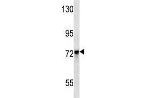 KEAP1 antibody western blot analysis in MDA-MB231 lysate. (KEAP1 Antikörper  (AA 422-449))
