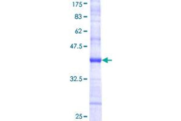 PDGFD Protein (AA 24-123) (GST tag)