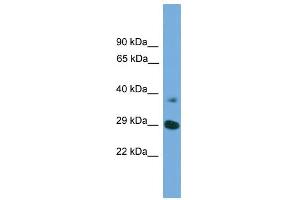 WB Suggested Anti-ATG16L1  Antibody Titration: 0. (ATG16L1 Antikörper  (Middle Region))