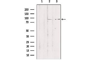 Western blot analysis of extracts from various samples, using ZNF148 Antibody. (ZNF148 Antikörper  (N-Term))