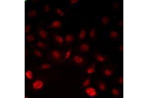 Immunofluorescent analysis of INTS6 staining in Hela cells.
