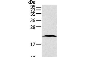 Western Blot analysis of Human lung cancer tissue using TAF10 Polyclonal Antibody at dilution of 1:400 (TAF10 Antikörper)