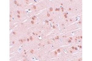 Immunohistochemical staining of rat brain tissue with SYNGR1 polyclonal antibody  at 25 ug/mL dilution. (Synaptogyrin 1 Antikörper)