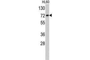 Western blot analysis of TOMM70A antibody (C-term) in HL60 cell line lysates (35ug/lane).