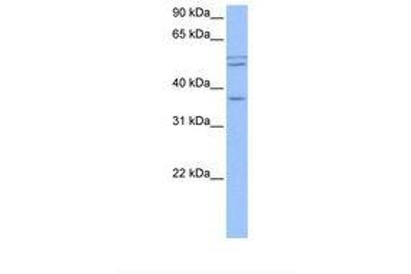 CCDC78 anticorps  (AA 127-165)