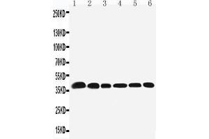 Anti-Nucleophosmin antibody, Western blotting Lane 1: Rat Testis Tissue Lysate Lane 2: Rat Brain Tissue Lysate Lane 3: HELA Cell Lysate Lane 4: U87 Cell Lysate Lane 5: A549 Cell LysateLane6: SMMC Cell Lysate