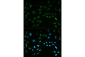 Immunofluorescence (IF) image for anti-Nuclear Factor (erythroid-Derived 2)-Like 2 (NFE2L2) (AA 366-605) antibody (ABIN3021832)
