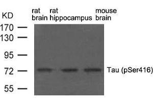 Western blot analysis of extract from rat brain, rat hippocampus and mouse brain using Tau(phospho-Ser416) Antibody. (MAPT Antikörper  (pSer416))