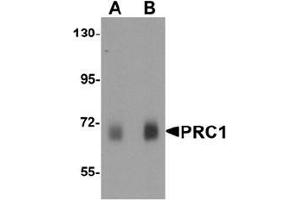 Western blot analysis of PRC1 in human skeletal muscle tissue lysate with Prc1 antibody at (A) 0. (PRC1 Antikörper  (Middle Region))