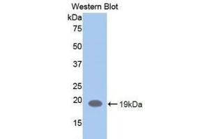 Detection of Recombinant LIFR, Human using Polyclonal Antibody to Leukemia Inhibitory Factor Receptor (LIFR) (LIFR Antikörper  (AA 692-833))