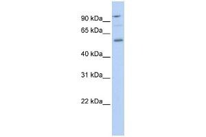 WB Suggested Anti-TEAD1 Antibody Titration: 0. (TEAD1 Antikörper  (Middle Region))