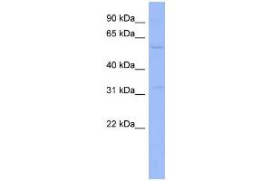 WB Suggested Anti-ZNF266 Antibody Titration:  0. (ZNF266 Antikörper  (Middle Region))
