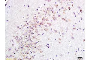 Formalin-fixed and paraffin embedded rat brain tissue labeled with Anti ENKEPHALIN/P-ENK Polyclonal Antibody, Unconjugated (ABIN677633) at 1:200 followed by conjugation to the secondary antibody and DAB staining. (Enkephalin Antikörper)