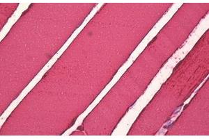 Anti-CKM antibody IHC staining of human skeletal muscle. (CKM Antikörper  (AA 10-59))