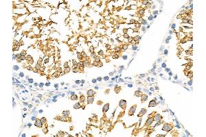 ABIN6257454 and ABIN6275443 at 1/100 staining Rat testis tissue by IHC-P. (RANBP17 Antikörper  (N-Term))