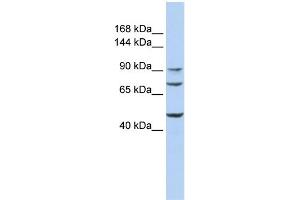 WB Suggested Anti-GALNT5 Antibody Titration:  0. (GALNT5 Antikörper  (Middle Region))