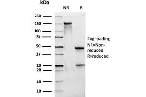 SDS-PAGE Analysis Purified CD28 Mouse Monoclonal Antibody (CB28).