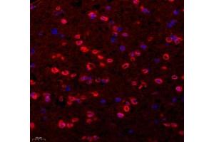 Immunofluorescence of paraffin embedded mouse corpus striatum using Tuba3a (ABIN7076051) at dilution of 1: 600 (400x lens) (Tuba3a Antikörper)