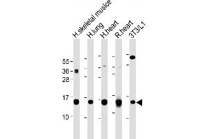 All lanes : Anti-FABP4 Antibody (Y20) at 1:2000-1:8000 dilution Lane 1: Human skeletal muslce lysate Lane 2: Human lung lysate Lane 3: Human heart lysate Lane 4: Rat heart lysate Lane 5: 3T3/L1 whole cell lysate Lysates/proteins at 20 μg per lane. (FABP4 Antikörper  (AA 1-30))