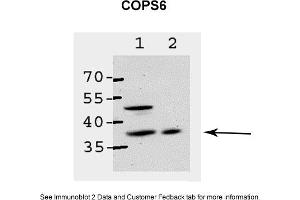 Sample Type: 1. (COPS6 Antikörper  (Middle Region))