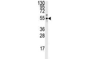 Western blot analysis of PTP1B antibody and Ramos lysate. (PTPN1 Antikörper)