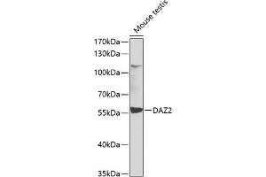 Western blot analysis of extracts of mouse testis, using D antibody (ABIN6127797, ABIN6139413, ABIN6139414 and ABIN6223512) at 1:1000 dilution. (DAZ2 Antikörper  (AA 1-200))