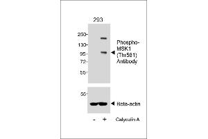 Western blot analysis of lysates from 293 cell line, untreated or treated with Calyculin A, 100nM, 30 min, using Phospho-MSK1 (Thr581) Antibody (upper) or Beta-actin (lower).