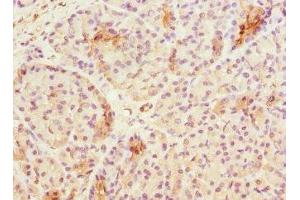 Immunohistochemistry (IHC) image for anti-Alveolar Soft Part Sarcoma Chromosome Region, Candidate 1 (ASPSCR1) (AA 284-553) antibody (ABIN7171839)