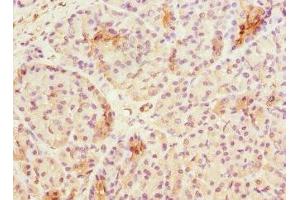 Immunohistochemistry of paraffin-embedded human pancreatic tissue using ABIN7171839 at dilution of 1:100 (ASPSCR1 Antikörper  (AA 284-553))