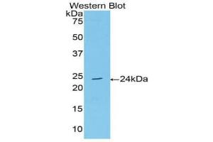 Detection of Recombinant AchE, Human using Polyclonal Antibody to Acetylcholinesterase (ACHE) (Acetylcholinesterase Antikörper  (AA 377-574))