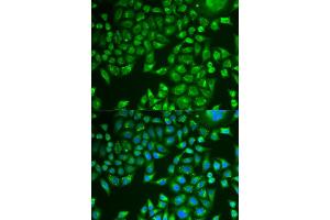 Immunofluorescence analysis of U2OS cells using PNLIP antibody . (PNLIP Antikörper  (AA 166-465))