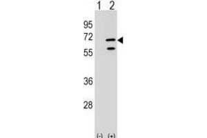 Western Blotting (WB) image for anti-Polymerase (RNA) III (DNA Directed) Polypeptide C (62kD) (POLR3C) antibody (ABIN2999296) (POLR3C Antikörper)