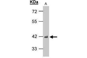 Western Blotting (WB) image for anti-TAR DNA Binding Protein (TARDBP) antibody (ABIN2854799)