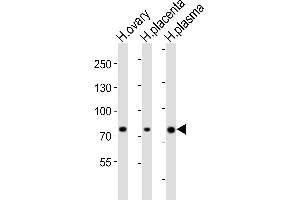 Western blot analysis of lysates from human ovary, human placenta, human plasma tissue lysate (from left to right), using ITGB8 Antibody (Center) (ABIN6244113 and ABIN6577824). (ITGB8 Antikörper  (AA 197-231))