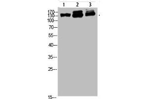 Western blot analysis of 823 293T-UV HELA Cell Lysate, antibody was diluted at 1:1000 (NFAT5 Antikörper  (AA 1268-1341))
