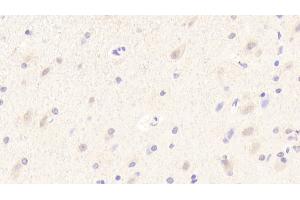Immunohistochemistry (IHC) image for anti-Myelin Oligodendrocyte Glycoprotein (MOG) (AA 30-149) antibody (ABIN7429418)